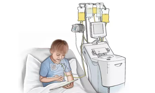 Plasmapheresis in Nagpur